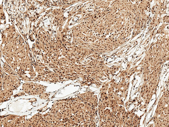 Immunohistochemistry analysis using Rabbit Anti-FUNDC1 Polyclonal Antibody (STPA00062). Tissue: Brain. Species: Human. Fixation: Formalin Fixed Paraffin-Embedded. Primary Antibody: Rabbit Anti-FUNDC1 Polyclonal Antibody (STPA00062) at 1:50 for 30 min at RT. Counterstain: Hematoxylin. Magnification: 10X. HRP-DAB Detection.