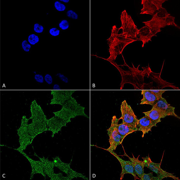 Immunocytochemistry/Immunofluorescence analysis using Rabbit Anti-ULK1 Polyclonal Antibody (STPA00063). Tissue: Neuroblastoma cell line (SK-N-BE). Species: Human. Fixation: 4% Formaldehyde for 15 min at RT. Primary Antibody: Rabbit Anti-ULK1 Polyclonal Antibody (STPA00063) at 1:100 for 60 min at RT. Secondary Antibody: Goat Anti-Rabbit ATTO 488 at 1:200 for 60 min at RT.