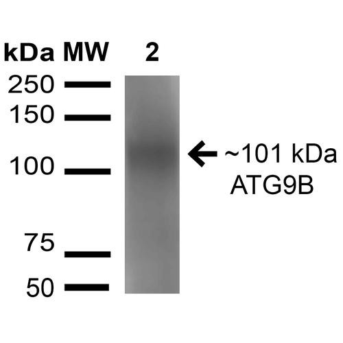 Western blot analysis of Rat Brain cell lysates showing detection of 101 kDa ATG9B protein using Rabbit Anti-ATG9B Polyclonal Antibody (STPA00064). Lane 1: Molecular Weight Ladder (MW). Lane 2: Rat Brain cell lysates. Load: 15 µg. Primary Antibody: Rabbit Anti-ATG9B Polyclonal Antibody (STPA00064) at 1:1000 for 16 hours at 4°C. Secondary Antibody: Goat Anti-Rabbit IgG: HRP at 1:2000 for 60 min at RT.