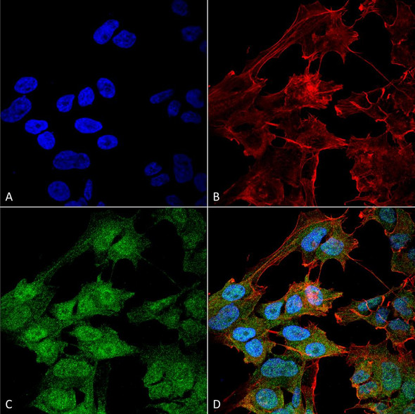 Immunocytochemistry/Immunofluorescence analysis using Rabbit Anti-ATG9B Polyclonal Antibody (STPA00064). Tissue: Neuroblastoma cell line (SK-N-BE). Species: Human. Fixation: 4% Formaldehyde for 15 min at RT. Primary Antibody: Rabbit Anti-ATG9B Polyclonal Antibody (STPA00064) at 1:100 for 60 min at RT. Secondary Antibody: Goat Anti-Rabbit IgG: Alexa Fluor 488 at 1:200 for 60 min at RT.