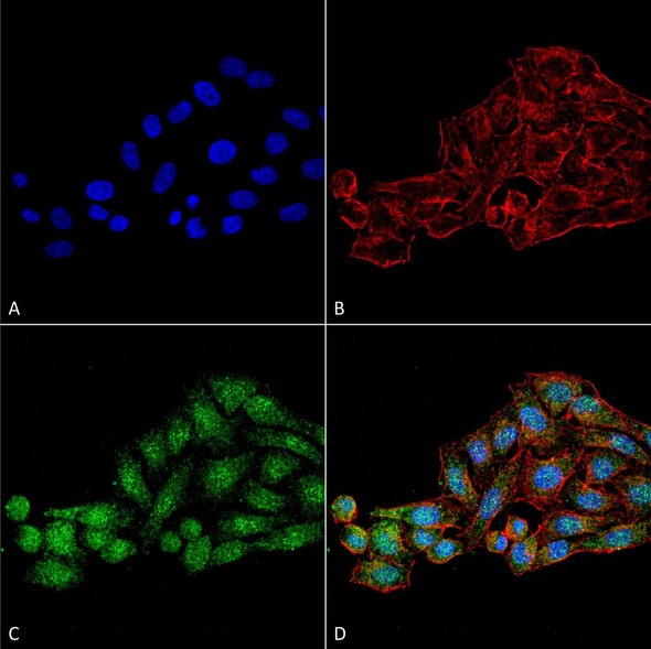 Immunocytochemistry/Immunofluorescence analysis using Rabbit Anti-WDR45 Polyclonal Antibody (STPA00065). Tissue: Cervical cancer cell line (HeLa). Species: Human. Fixation: 4% Formaldehyde for 15 min at RT. Primary Antibody: Rabbit Anti-WDR45 Polyclonal Antibody (STPA00065) at 1:100 for 60 min at RT. Secondary Antibody: Goat Anti-Rabbit ATTO 488 at 1:200 for 60 min at RT.