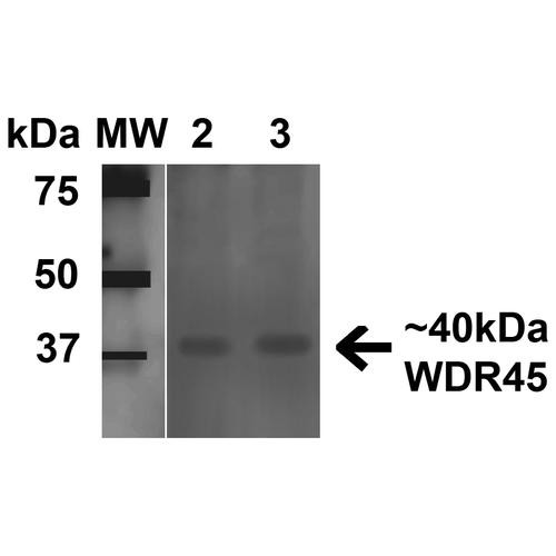 Western blot analysis of Human Embryonic kidney epithelial cell line (HEK293T) lysate showing detection of 40 kDa WDR45 protein using Rabbit Anti-WDR45 Polyclonal Antibody (STPA00065). Lane 1: Molecular Weight Ladder (MW). Lane 2: HeLa cell lysates. Lane 3: 293Trap cell lysates. Load: 15 µg. Block: 5% Skim Milk in 1X TBST. Primary Antibody: Rabbit Anti-WDR45 Polyclonal Antibody (STPA00065) at 1:1000 for 1 hour at RT.