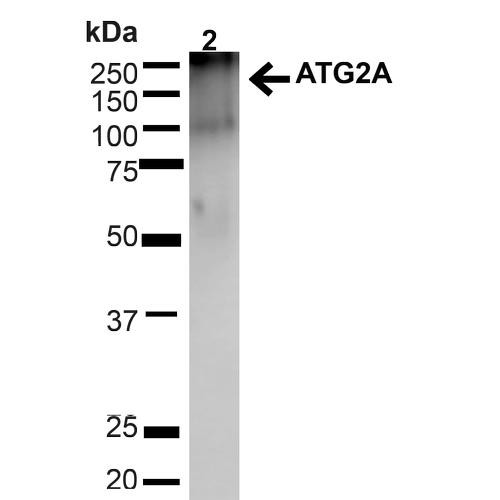 Western blot analysis of Mouse Brain showing detection of ~212.9kDa ATG2A protein using Rabbit Anti-ATG2A Polyclonal Antibody (STPA00066). Lane 1: MW Ladder. Lane 2: Mouse Brain (20 µg). Load: 20 µg. Block: 5% milk + TBST for 1 hour at RT. Primary Antibody: Rabbit Anti-ATG2A Polyclonal Antibody (STPA00066) at 1:1000 for 1 hour at RT. Secondary Antibody: Goat Anti-Rabbit: HRP at 1:2000 for 1 hour at RT.