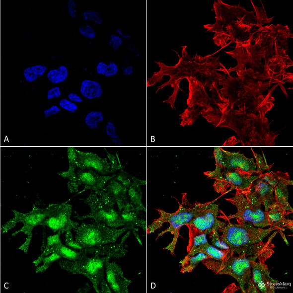 Immunocytochemistry/Immunofluorescence analysis using Rabbit Anti-ATG2A Polyclonal Antibody (STPA00066). Tissue: Neuroblastoma cell line (SK-N-BE). Species: Human. Fixation: 4% Formaldehyde for 15 min at RT. Primary Antibody: Rabbit Anti-ATG2A Polyclonal Antibody (STPA00066) at 1:100 for 60 min at RT. Secondary Antibody: Goat Anti-Rabbit ATTO 488 at 1:100 for 60 min at RT.