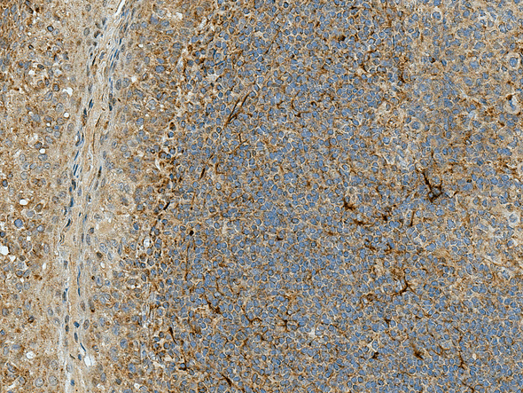 Immunohistochemistry analysis using Rabbit Anti-Rubicon Polyclonal Antibody (STPA00067). Tissue: Tonsil. Species: Human. Fixation: Formalin Fixed Paraffin-Embedded. Primary Antibody: Rabbit Anti-Rubicon Polyclonal Antibody (STPA00067) at 1:50 for 30 min at RT. Counterstain: Hematoxylin. Magnification: 20X. HRP-DAB Detection.