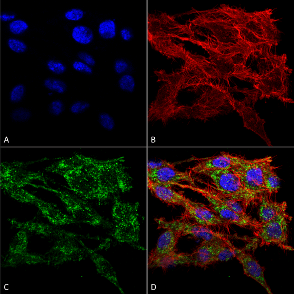 Immunocytochemistry/Immunofluorescence analysis using Rabbit Anti-VMP1 Polyclonal Antibody (STPA00068). Tissue: Colon carcinoma cell line (RKO). Species: Human. Fixation: 4% Formaldehyde for 15 min at RT. Primary Antibody: Rabbit Anti-VMP1 Polyclonal Antibody (STPA00068) at 1:100 for 60 min at RT. Secondary Antibody: Goat Anti-Rabbit ATTO 488 at 1:100 for 60 min at RT.