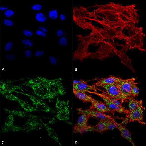 Immunocytochemistry/Immunofluorescence analysis using Rabbit Anti-VMP1 Polyclonal Antibody (STPA00068). Tissue: Colon carcinoma cell line (RKO). Species: Human. Fixation: 4% Formaldehyde for 15 min at RT. Primary Antibody: Rabbit Anti-VMP1 Polyclonal Antibody (STPA00068) at 1:100 for 60 min at RT. Secondary Antibody: Goat Anti-Rabbit ATTO 488 at 1:100 for 60 min at RT.