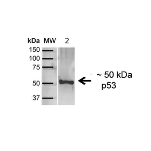 Western blot analysis of Human A431 showing detection of ~43.7kDa p53 protein using Rabbit Anti-p53 Polyclonal Antibody (STPA00069). Lane 1: MW Ladder. Lane 2: Human A431 (20 µg). Load: 20 µg. Block: 5% milk + TBST for 1 hour at RT. Primary Antibody: Rabbit Anti-p53 Polyclonal Antibody (STPA00069) at 1:1000 for 1 hour at RT. Secondary Antibody: Goat Anti-Rabbit: HRP at 1:2000 for 1 hour at RT. Color Development: TMB solution for 12 min at RT.