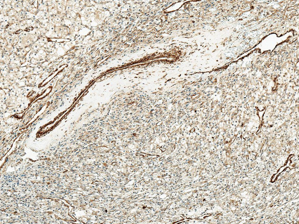 Immunohistochemistry analysis using Rabbit Anti-Kir4.1 Polyclonal Antibody (STPA00071). Tissue: Kidney. Species: Human. Fixation: Formalin Fixed Paraffin-Embedded. Primary Antibody: Rabbit Anti-Kir4.1 Polyclonal Antibody (STPA00071) at 1:50 for 30 min at RT. Counterstain: Hematoxylin. Magnification: 10X. HRP-DAB Detection.