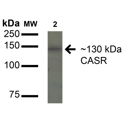 Western blot analysis of Human HeLa cell lysates showing detection of 130kDa Calcium Sensing Receptor protein using Rabbit Anti-Calcium Sensing Receptor Polyclonal Antibody (STPA00075). Lane 1: Molecular Weight Ladder (MW). Lane 2: HeLa cell lysates. Load: 15 µg. Block: 5% Skim Milk in 1X TBST. Primary Antibody: Rabbit Anti-Calcium Sensing Receptor Polyclonal Antibody (STPA00075) at 1:1000 for 16 hours at 4°C.