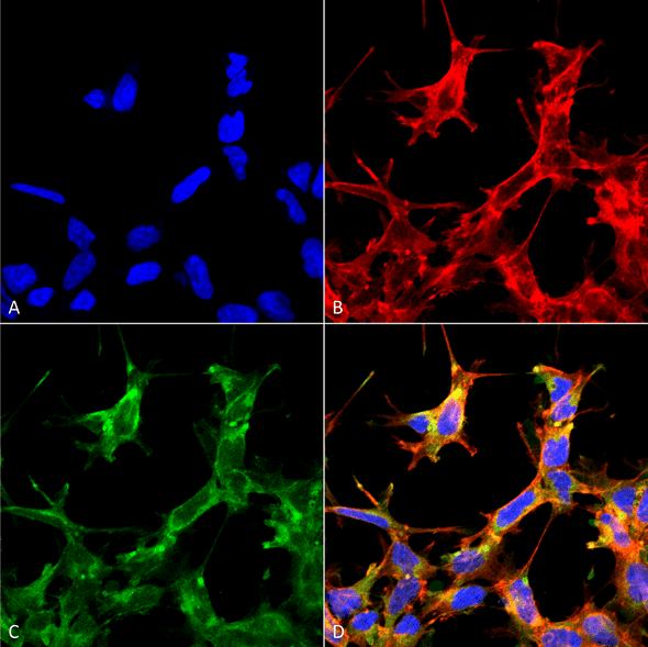 Immunocytochemistry/Immunofluorescence analysis using Rabbit Anti-HSP70 Acetyl Lys77 Polyclonal Antibody (STPA00079). Tissue: Embryonic kidney cells (HEK293) cultured overnight with 50 µM H2O2. Species: Human. Fixation: 5% Formaldehyde for 5 min. Primary Antibody: Rabbit Anti-HSP70 Acetyl Lys77 Polyclonal Antibody (STPA00079) at 1:60 for 30-60 min at RT. Secondary Antibody: Goat Anti-Rabbit Alexa Fluor 488 at 1:1500 for 30-60 min at RT.