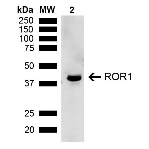 Western blot analysis of Rat Kidney showing detection of ~43 kDa ROR1 protein using Rabbit Anti-ROR1 Polyclonal Antibody (STPA00081). Lane 1: Molecular Weight Ladder (MW). Lane 2: Rat Kidney. Load: 15 µg. Block: 5% Skim Milk in 1X TBST. Primary Antibody: Rabbit Anti-ROR1 Polyclonal Antibody (STPA00081) at 1:1000 for 2 hours at RT. Secondary Antibody: Goat Anti-Rabbit IgG: HRP at 1:4000 for 1 hour at RT.