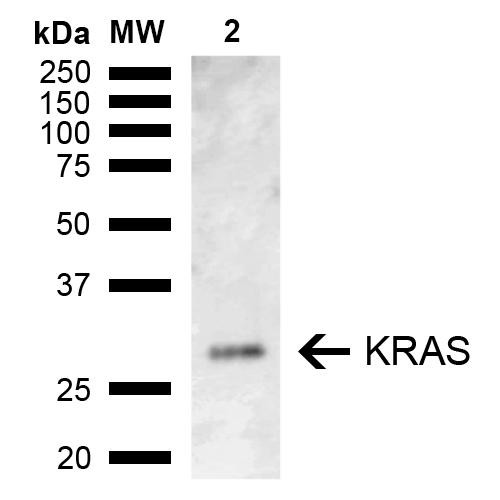 Western blot analysis of Rat Kidney showing detection of ~21.6 kDa KRAS protein using Rabbit Anti-KRAS Polyclonal Antibody (STPA00082). Lane 1: Molecular Weight Ladder (MW). Lane 2: Rat Kidney. Load: 15 µg. Block: 5% Skim Milk in 1X TBST. Primary Antibody: Rabbit Anti-KRAS Polyclonal Antibody (STPA00082) at 1:1000 for 2 hours at RT. Secondary Antibody: Goat Anti-Rabbit IgG: HRP at 1:5000 for 1 hour at RT.