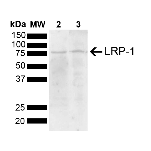 Western blot analysis of Mouse, Rat Brain showing detection of 504.6 kDa LRP-1 protein using Rabbit Anti-LRP-1 Polyclonal Antibody (STPA00084). Load: 15 µg. Block: 5% Skim Milk powder in TBST. Primary Antibody: Rabbit Anti-LRP-1 Polyclonal Antibody (STPA00084) at 1:1000 for 2 hours at RT with shaking. Secondary Antibody: Goat Anti-Rabbit IgG: HRP at 1:5000 for 1 hour at RT. Color Development: ECL solution for 5 min at RT.