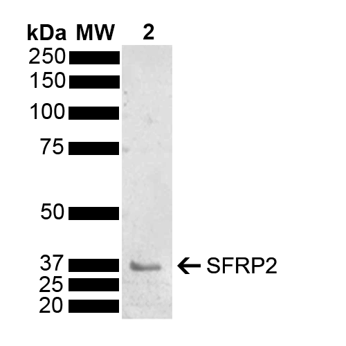 Western blot analysis of Mouse Brain showing detection of 33.5 kDa SFRP2 protein using Rabbit Anti-SFRP2 Polyclonal Antibody (STPA00085). Load: 15 µg. Block: 5% Skim Milk powder in TBST. Primary Antibody: Rabbit Anti-SFRP2 Polyclonal Antibody (STPA00085) at 1:1000 for 2 hours at RT with shaking. Secondary Antibody: Goat Anti-Rabbit IgG: HRP at 1:5000 for 1 hour at RT. Color Development: ECL solution for 5 min at RT.