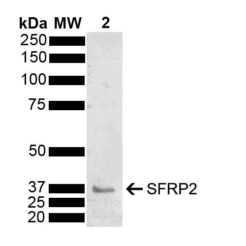 Western blot analysis of Mouse Brain showing detection of 33.5 kDa SFRP2 protein using Rabbit Anti-SFRP2 Polyclonal Antibody (STPA00085). Load: 15 µg. Block: 5% Skim Milk powder in TBST. Primary Antibody: Rabbit Anti-SFRP2 Polyclonal Antibody (STPA00085) at 1:1000 for 2 hours at RT with shaking. Secondary Antibody: Goat Anti-Rabbit IgG: HRP at 1:5000 for 1 hour at RT. Color Development: ECL solution for 5 min at RT.