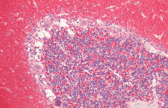 Immunohistochemistry analysis using Rabbit Anti-Alpha Synuclein Polyclonal Antibody (STPA00086). Tissue: Cerebellum. Species: Human. Fixation: Formalin fixed paraffin-embedded. Primary Antibody: Rabbit Anti-Alpha Synuclein Polyclonal Antibody (STPA00086).