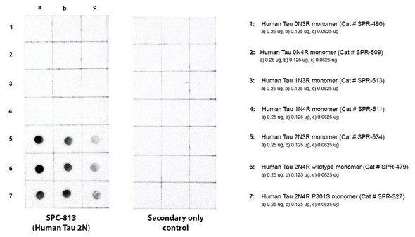 Dot blot analysis comparing detection of Tau isoforms. Of note is that STPA00091 does not bind to 0N or 1N isoforms. Block: 5% skim milk. Primary Antibody: Anti-human Tau 2N3R/4R polyclonal antibody (STPA00091) incubated for 1/2 hour at RT. Secondary Antibody: Goat anti-rabbit IgG:HRP at 1:4000 for 1/2 hour at RT. Color Development: Chemiluminescent for HRP (Moss) for 1 min in RT. Exposed 1 second.
