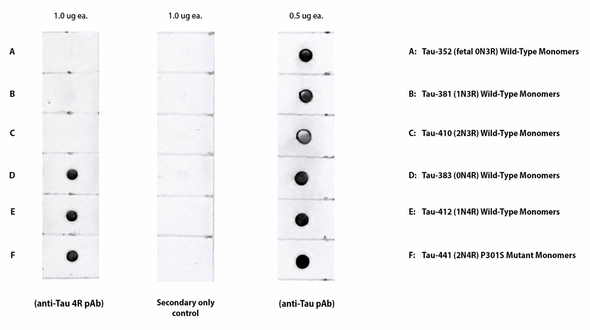 Anti-Tau 4R Antibody