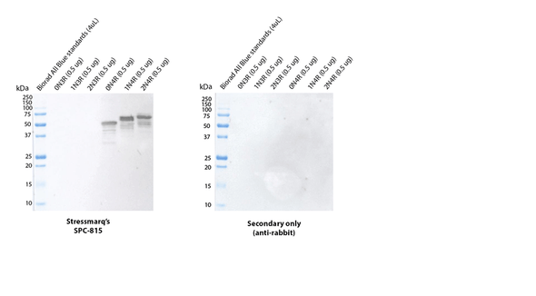 Western blot analysis using STPA00092 on purified Human Recombinant Tau isoforms comparing detection of the targets. Protein was transferred to nitrocellulose, blocked with 5% BSA, incubated with the primary antibody at 1:1000 dilution, followed by incubation in the secondary antibody at 1:4000 dilution. Secondary control is goat-anti-rabbit:HRP. Exposed 5 seconds.