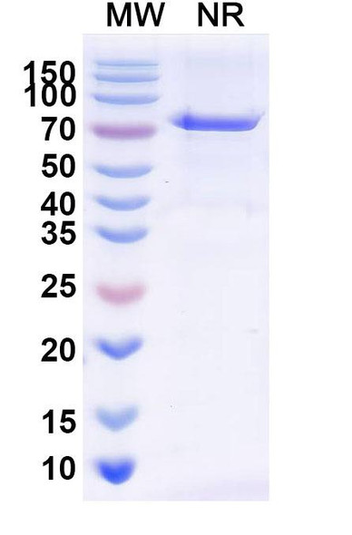 Radretumab Antibody - SDS-PAGE