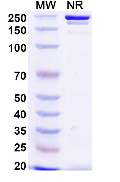 Votumumab Antibody - SDS-PAGE