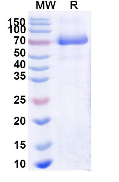 Naglazyme/Galsulfase (Research-Grade) - SDS-PAGE