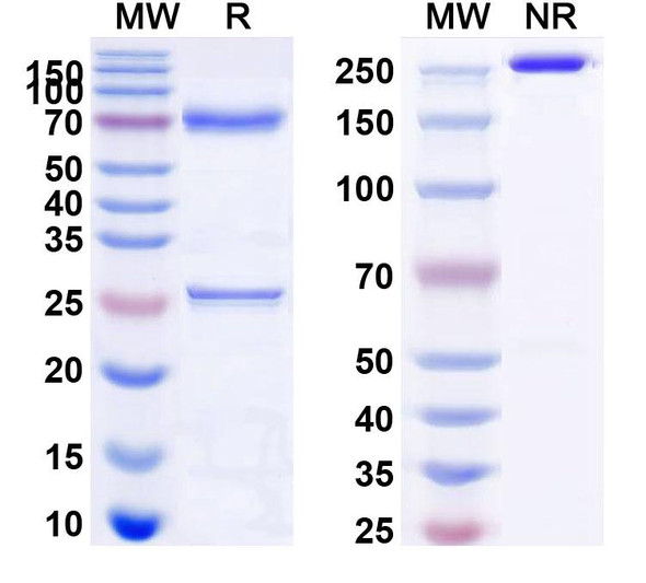 Brentuximab Antibody (Brentuximab Vedotin ADC, Payload-Free) - SDS-PAGE
