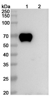 Zilovertamab Antibody (Zilovertamab Vedotin ADC, Payload-Free) - WB