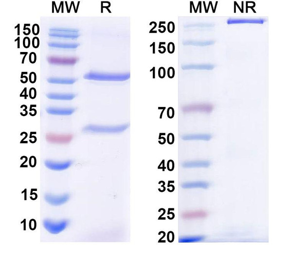 Anti-Corynephage omega DT/Diphtheria toxin Antibody (DTD4) - SDS-PAGE