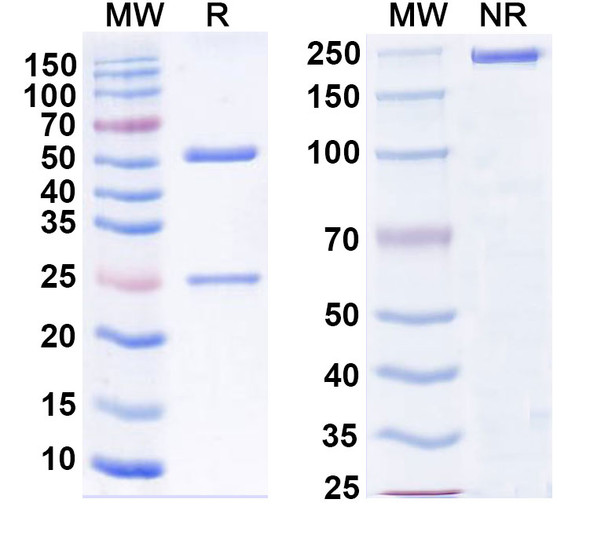 Anti-SARS-CoV-2 RBD Antibody (S2E12) - SDS-PAGE