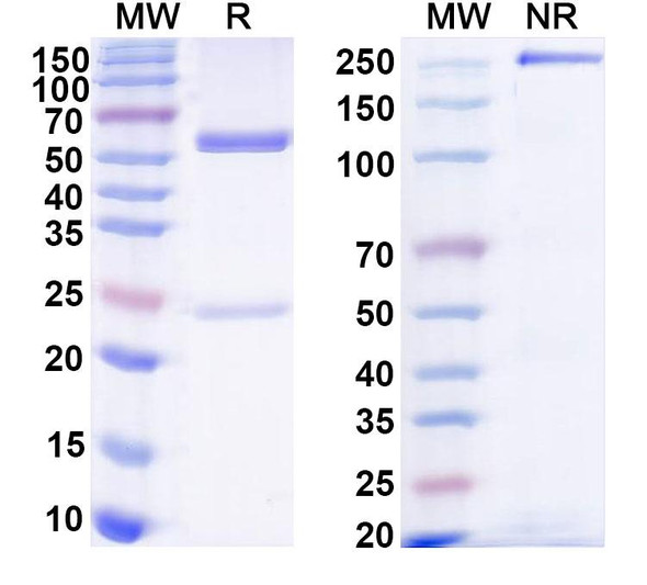 Anti-HPV18 L1/Major capsid protein L1 Antibody (H18L1-A) - SDS-PAGE