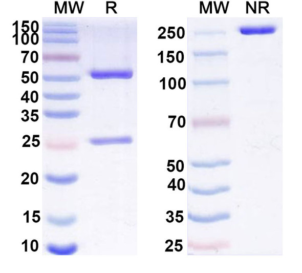 Human GAS6 (KM5320) Antibody - SDS-PAGE