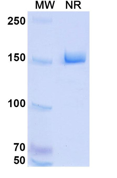 HKT288 Antibody (ADC, Payload-Free) - SDS-PAGE