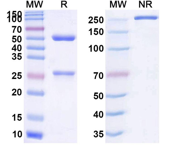 Human CD73/NT5E (PM 1015) Antibody - SDS-PAGE