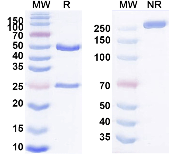 Human ACTH (ALD1613) Antibody - SDS-PAGE