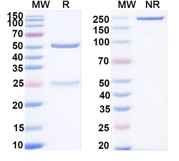 Human ADAM9 (IMGC936) Antibody (ADC, Payload-Free) - SDS-PAGE