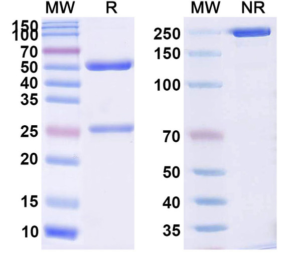 Human SNCA/Alpha-synuclein (ABL301) Antibody - SDS-PAGE