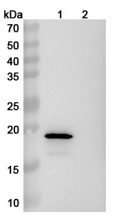 Human SNCA/Alpha-synuclein (Lu AF82422) Antibody - WB