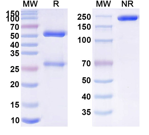 Human APP/Amyloid beta (C705) Antibody - SDS-PAGE