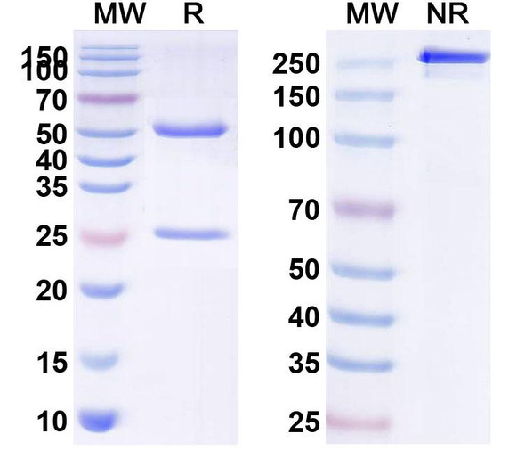 Human ASGR1 (SBT8230) Antibody - SDS-PAGE