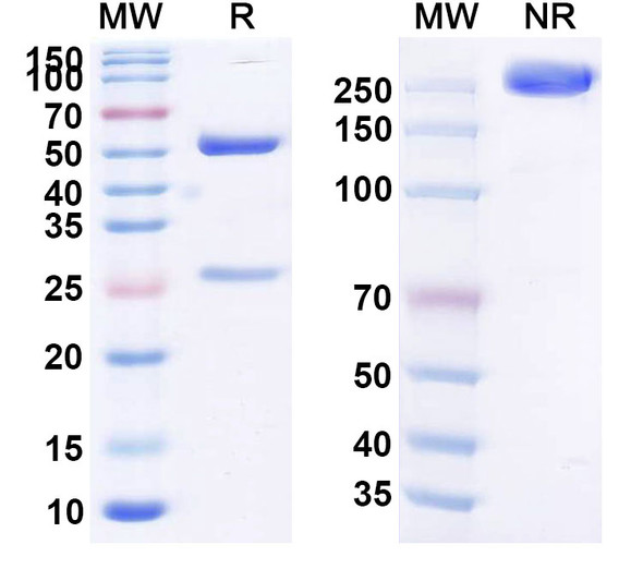 Human C5 (BOW080) Antibody - SDS-PAGE