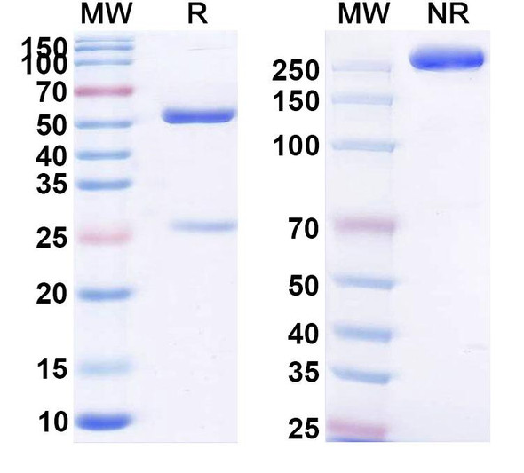 Human CD88/C5AR1 (ADC-1004) Antibody - SDS-PAGE