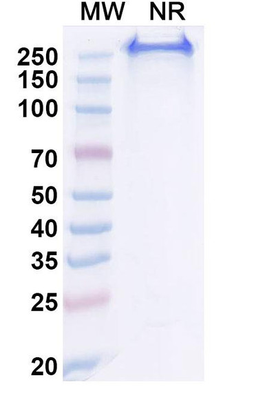 Human CA9 (BAY 794620) Antibody (ADC, Payload-Free) - SDS-PAGE