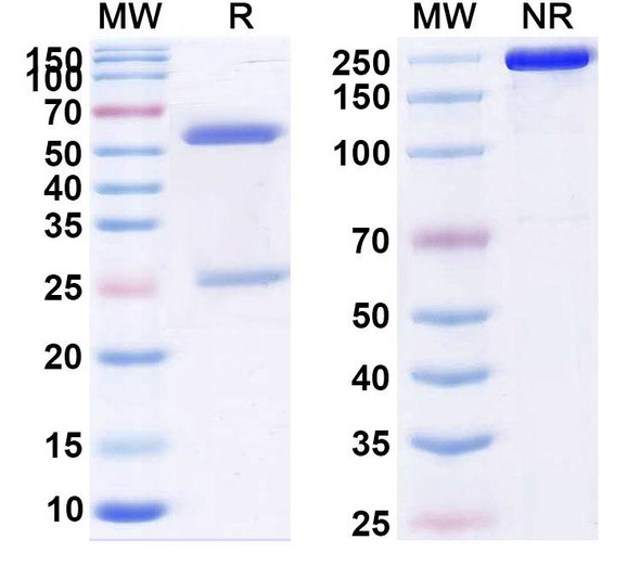 Human CD198/CCR8 (HFB101110) Antibody - SDS-PAGE