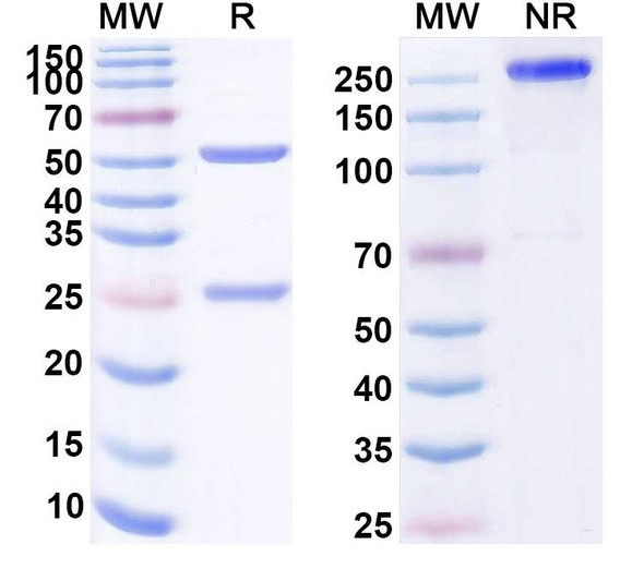 Human CD160 (MAT 303) Antibody - SDS-PAGE