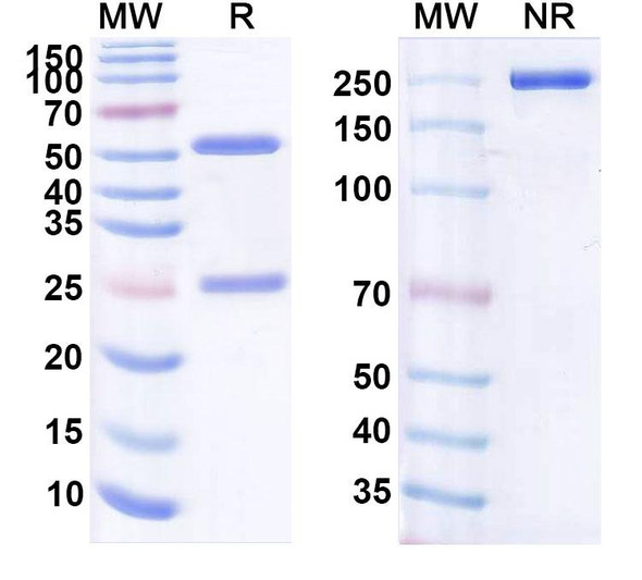 Human CD19 (IKS03) Antibody (ADC, Payload-Free) - SDS-PAGE