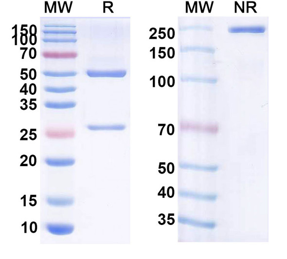 Human CD19 (RC58) Antibody - SDS-PAGE