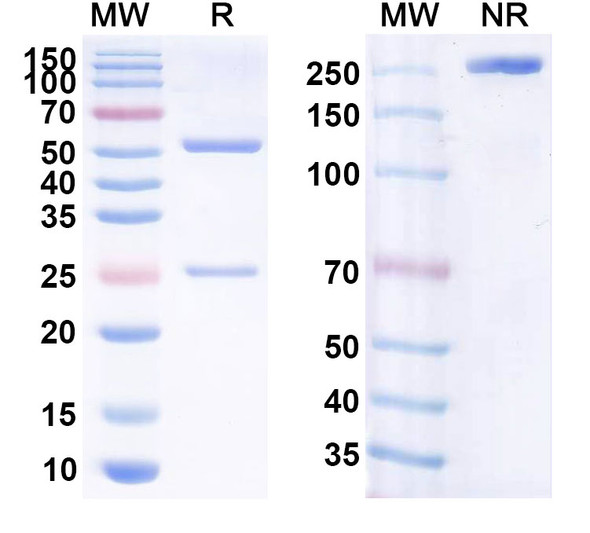 Human CD20/MS4A1 (Zitux) Antibody - SDS-PAGE