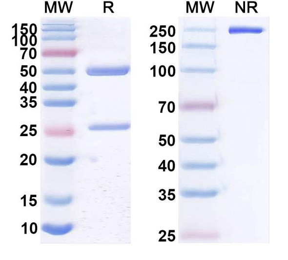 Human CD20/MS4A1 (TRU015) Antibody - SDS-PAGE